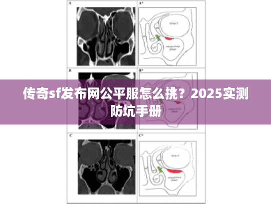 传奇sf发布网公平服怎么挑？2025实测防坑手册