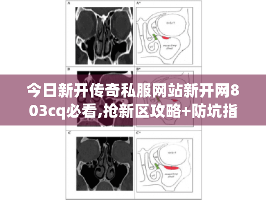 今日新开传奇私服网站新开网803cq必看,抢新区攻略+防坑指南