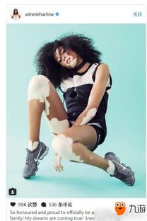 《模拟人生4》白癜风模拟人走红全球，独特造型引关注