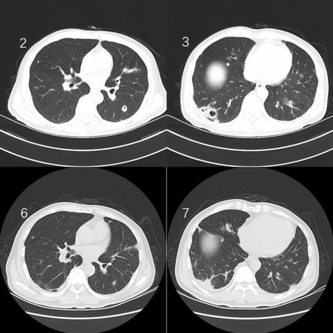《空洞骑士丝之歌》全工具获取攻略：高效收集秘籍大揭秘