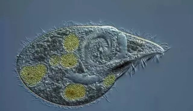 纤毛虫超自然现踪地，揭示切尔诺贝利神秘力量