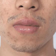 小米汽车SU7底盘揭秘：供应商阵容大起底